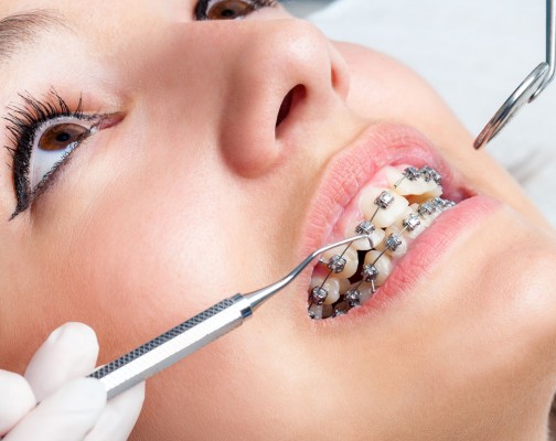 Best Orthodontic treatment in Rajahmundry